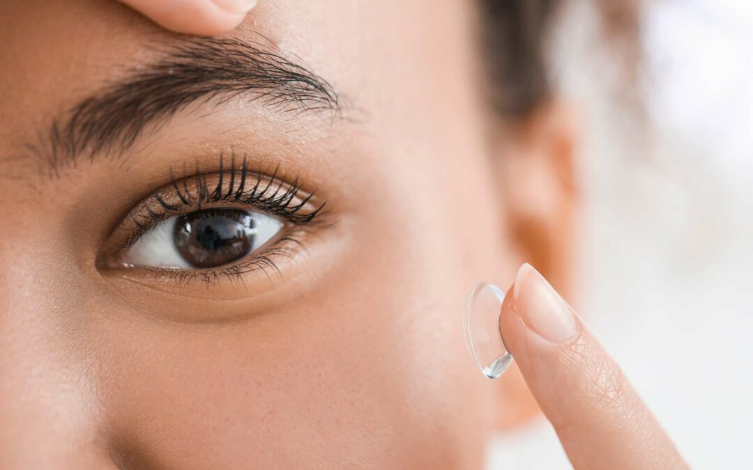 Lentilles de contact pour kératocône : comment elles sont utilisées pour traiter cette affection oculaire ?