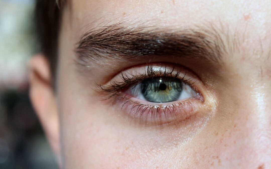 Lentilles pour les yeux sensibles : Solutions adaptées aux épidermes fragiles